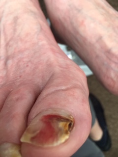 Foot image