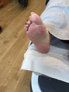 Foot image